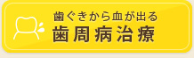 歯ぐきから血が出る 歯周病治療